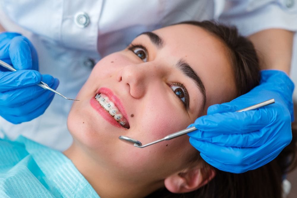 How Braces Work- Elements of the orthodontic treatment and its